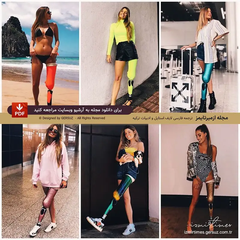 مدل اندام برزیلی پائولا آنتونینی پس از تصادف با پای مصنوعی